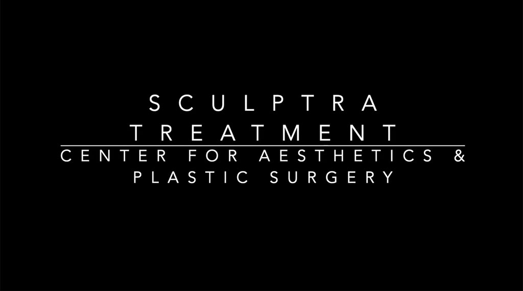 Sculptra Grand Rapids